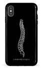 iPhone XS Max tough Aspects associés -